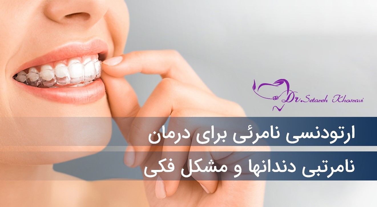 اصلاح طرح لبخند