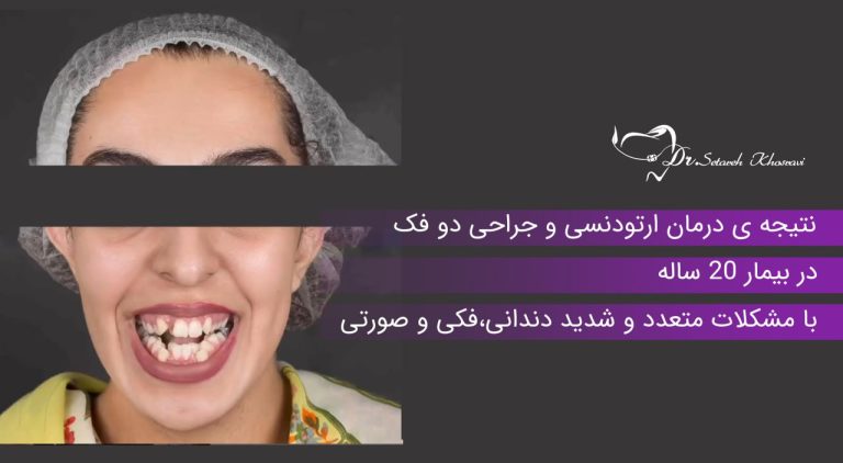 درمان ارتودنسی و جراحی دو فک