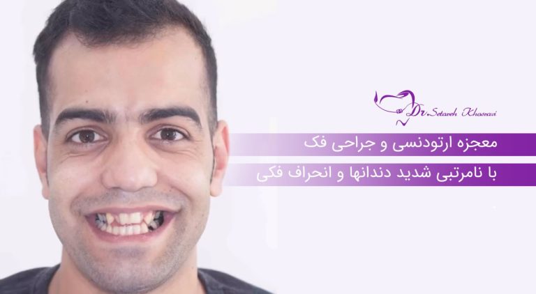 معجزه ارتودنسی و جراحی فک