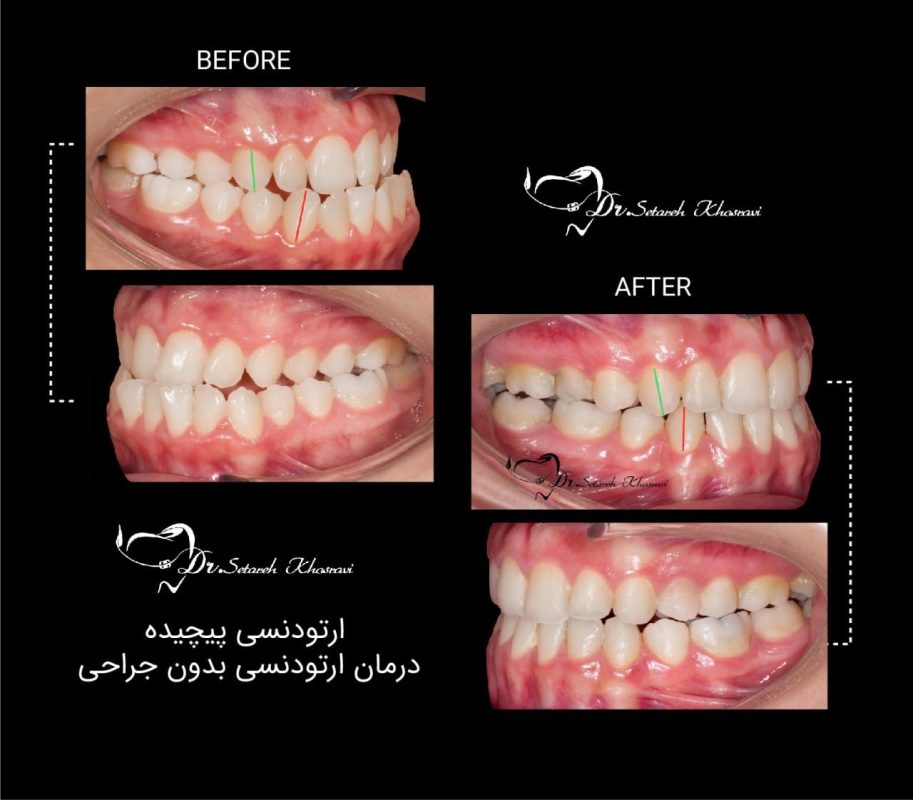 ارتودنسی دندان