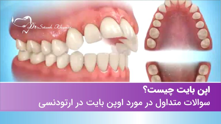 اوپن بایت
