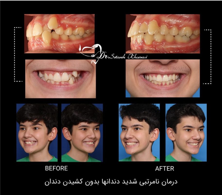 متخصص ارتودنسی