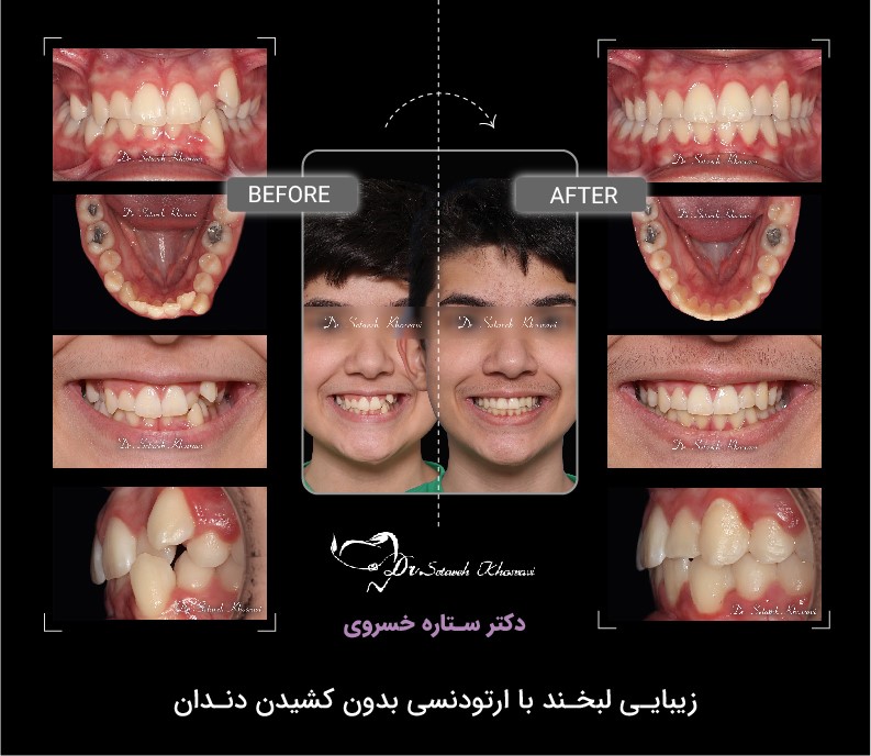 ارتودنسی اقساطی