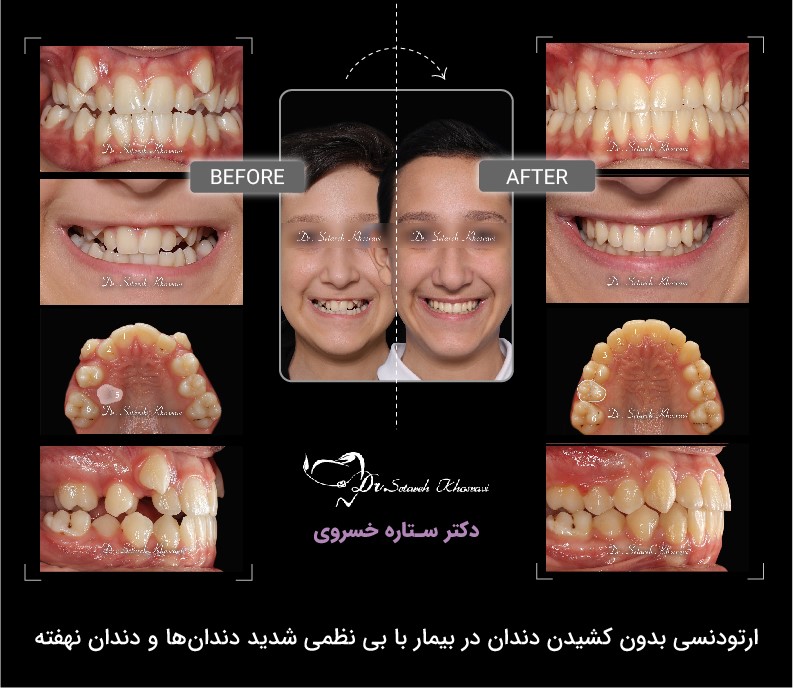 ارتودنسی اقساطی در تهران