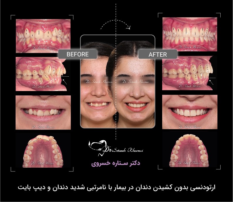 ارتودنسی اقساطی