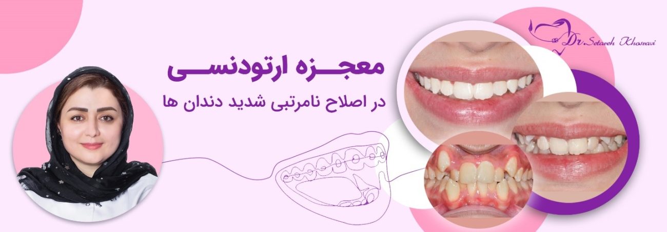 ارتودنسی اقساطی