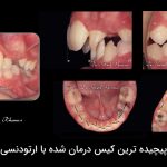 پیچیده ترین کیس درمان شده با ارتودنسی