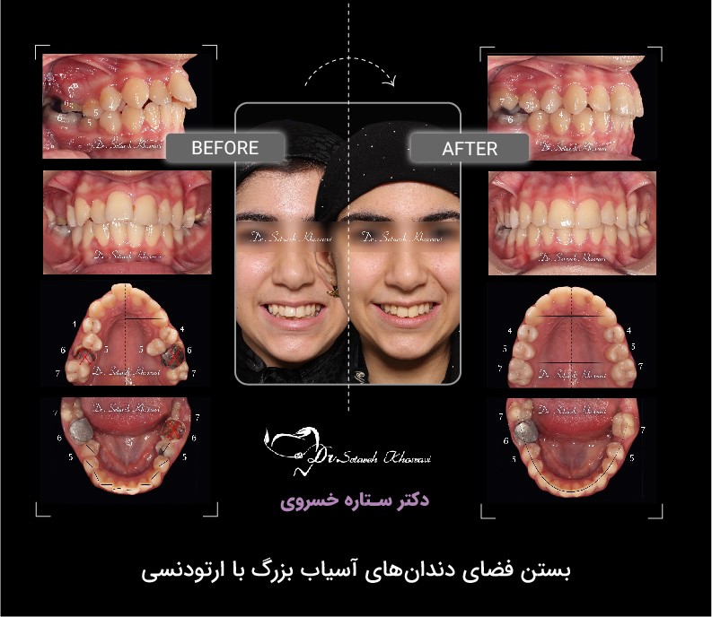 الاینر