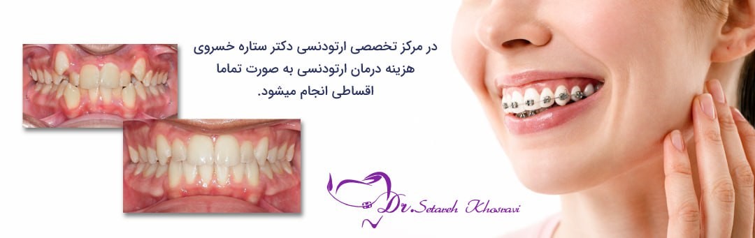 دکتر ارتودنسی خوب در تهران