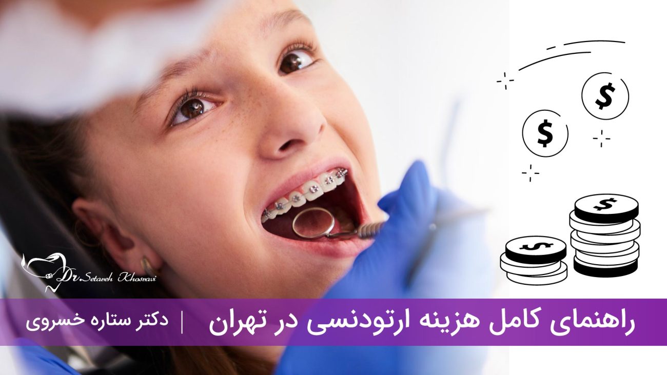 هزینه ارتودنسی در تهران