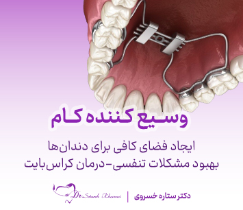 banner3 موبایل